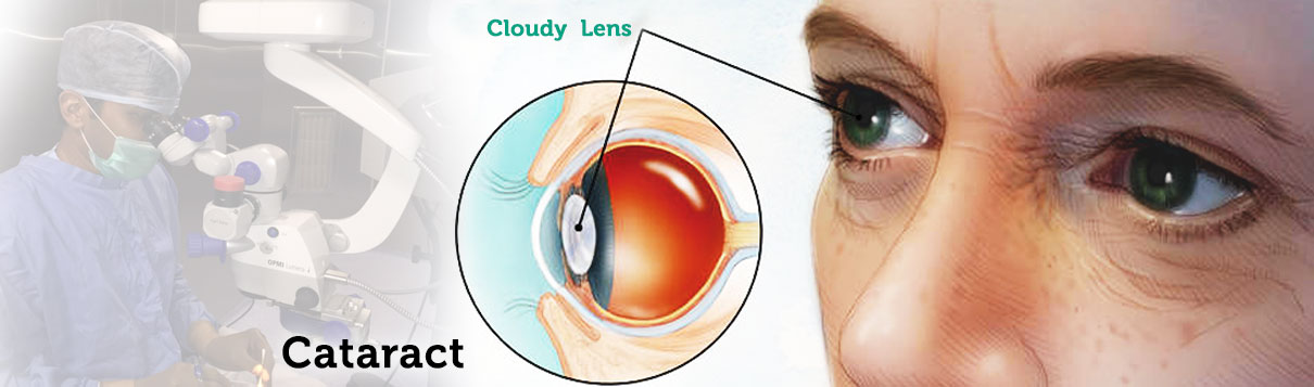 best cataract surgery in faizabad,best cornea & refractive treatment in faizabad,best dry eye treatment in faizabad,best eye clinic in faizabad,best eye clinic in janana hospital road,
best eye doctor in faizabad,best eye hospital in faizabad,best eye specialist in faizabad,best eye specialists in faizabad,best eye surgeon in faizabad,best eye surgery specialist in faizabad,
best glaucoma treatment in faizabad,