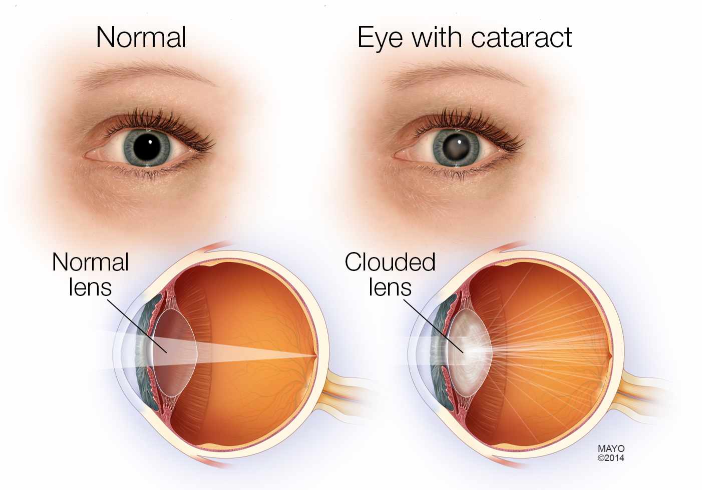 best cataract surgery in faizabad,best cornea & refractive treatment in faizabad,best dry eye treatment in faizabad,best eye clinic in faizabad,best eye clinic in janana hospital road,
best eye doctor in faizabad,best eye hospital in faizabad,best eye specialist in faizabad,best eye specialists in faizabad,best eye surgeon in faizabad,best eye surgery specialist in faizabad,
best glaucoma treatment in faizabad,